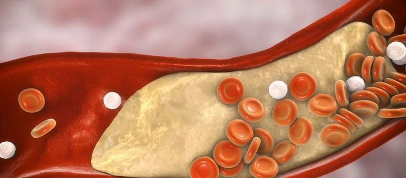 Οκτώ τροφές που θα σας βοηθήσουν να μειώσετε την χοληστερίνη μετά τις υπερβολές του Πάσχα